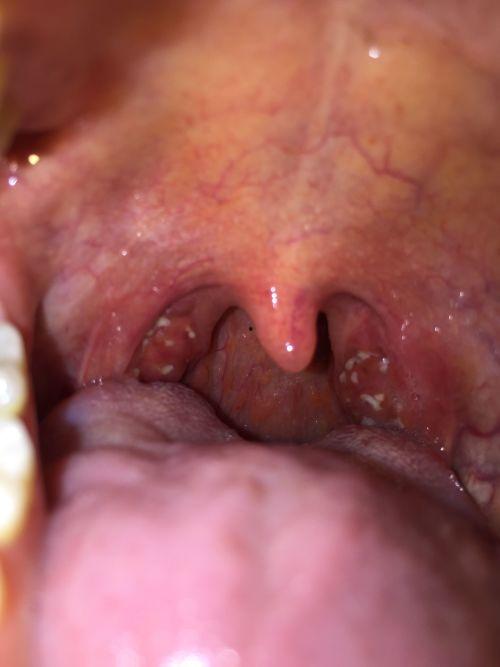 吃瓜粘喉咙咽不下  第3张