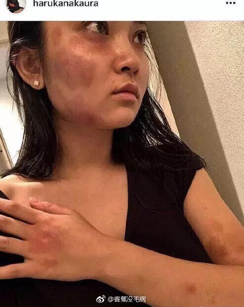 吃瓜照片丑男人,揭秘吃瓜照片背后的故事